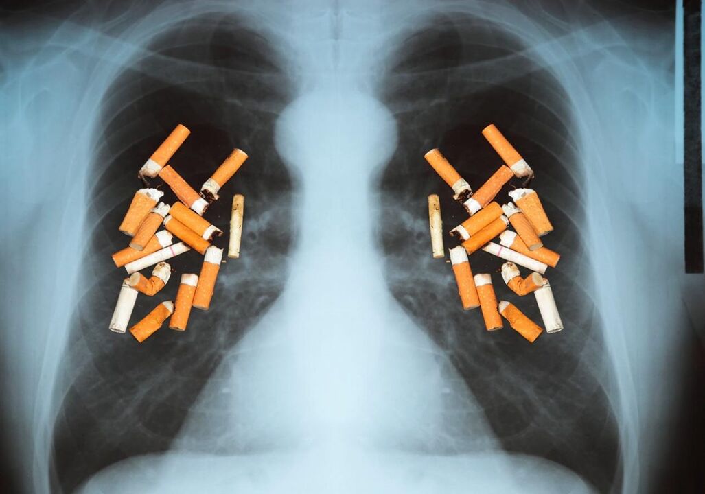 Comment les cigarettes affectent les poumons